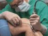 tratamentul_chirurgical_pentru_varice1.jpg