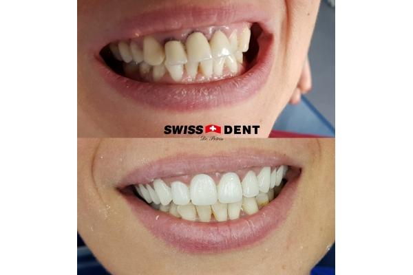 Clinica Dr. Petriu - SWISSDENT - 20190311_210746.jpg