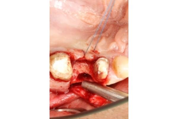Clinica Dr. Dragus - Implant_$R.jpg