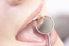 Bolile gingiilor (gingivita si paradontopatia)