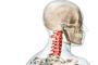 Siringomielia, o afectiune neurologica asociata cu malformatii congenitale ale creierului