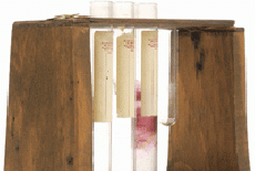 Analiza hormonilor (hormonul de sarcina, hormonii glandei tiroide, hormonii glandelor suprarenale, frotiu citohormonal)