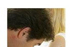Cancerul de piele nemelanomatos