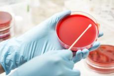 Infectia cu ureaplasma – cauze, simptome, tratament