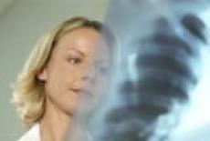 Pneumonia de aspiratie