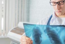 Pneumonia pneumococica - manifestari clinice, evolutie, complicatii, tratament